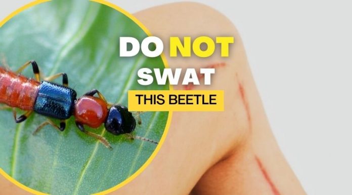 Do not swat this beetle Paederus Rove beetle