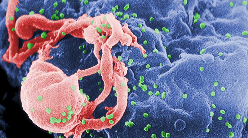 Scanning electron micrograph of HIV-1, colored green, budding from a cultured lymphocyte.