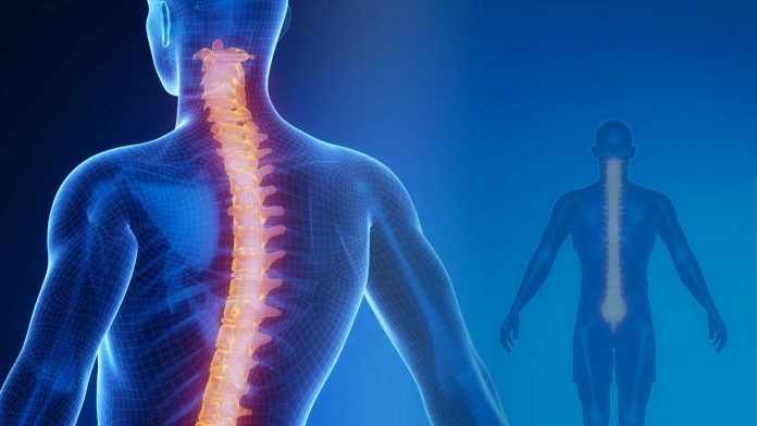 Scoliosis is a sideways curvature of the spine that most often is diagnosed in adolescents